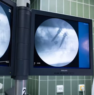 Pooperační rentgenový snímek zavedených systémů uCentum a ELBA v boční projekci