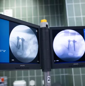 Pooperační rentgenový snímek zavedených systémů uCentum a PIANOSA v boční projekci