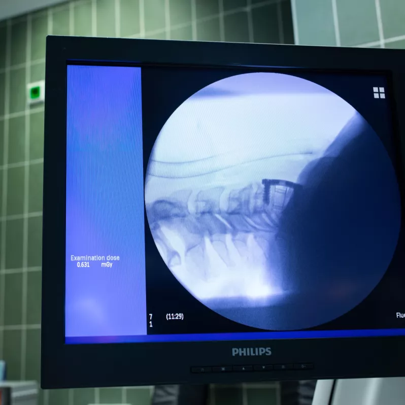 Peroperative view of the SHARK CP PRO plate and the ECHINUS Invadur cage